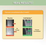 CH-Alpha Osteo Fortibone® (Rebuild Bone Density & Prevent Fractures) with Calcium Lactate - 3 Box